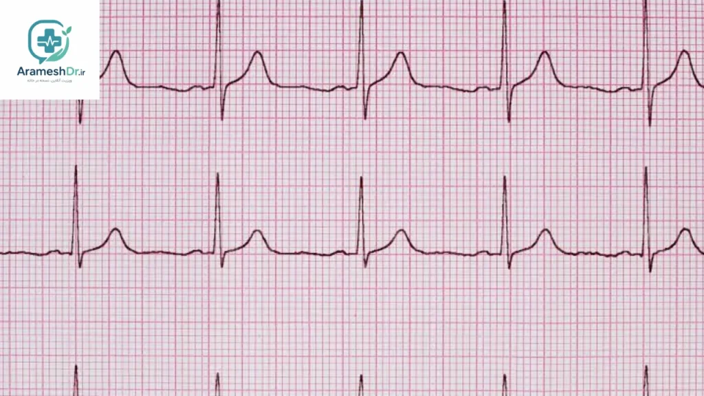 دریافت نسخه نوار قلب ECG آنلاین؛ بدون مراجعه حضوری