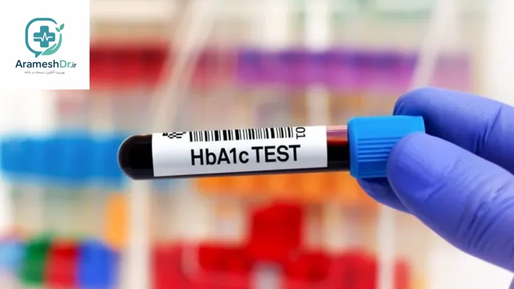 نسخه آزمایش HbA1c آنلاین؛ دریافت سریع نسخه برای بررسی میانگین قند خون