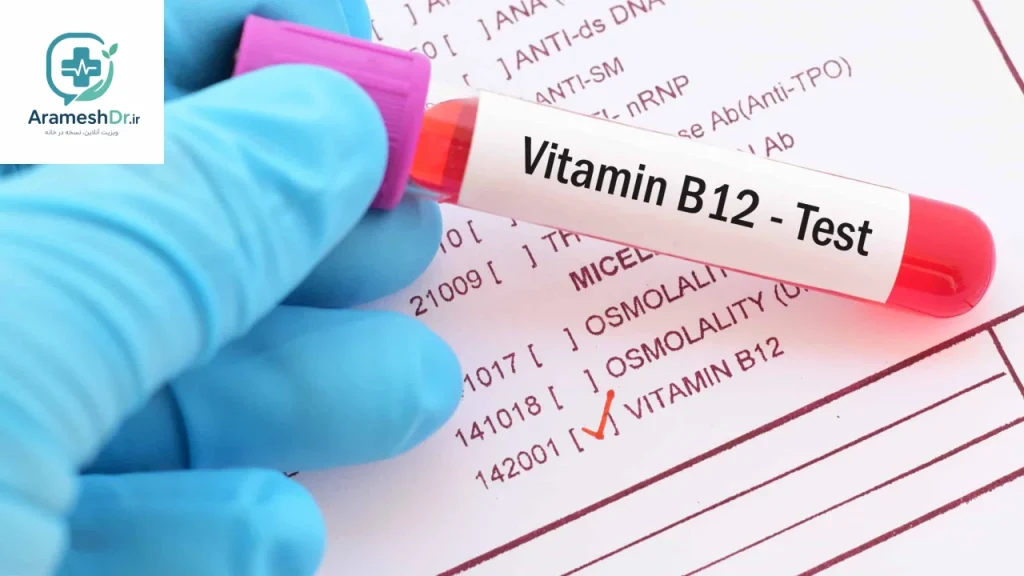 نسخه آزمایش B12 آنلاین؛ بدون مراجعه حضوری